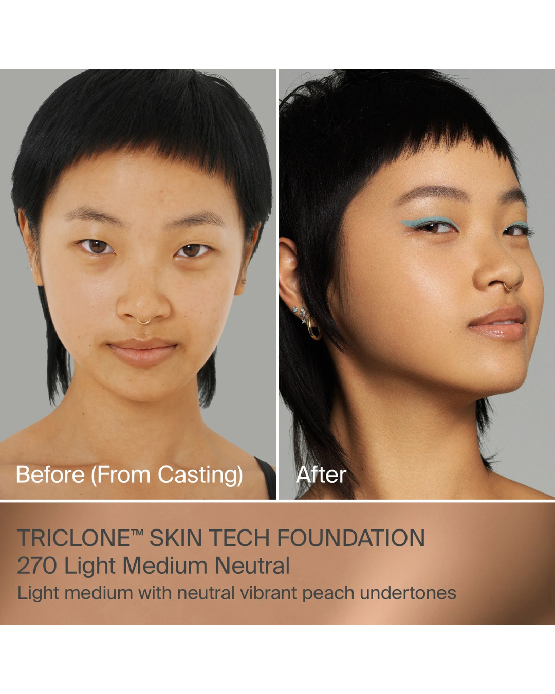 TRICLONE™ SKIN TECH MEDIUM COVERAGE FOUNDATION