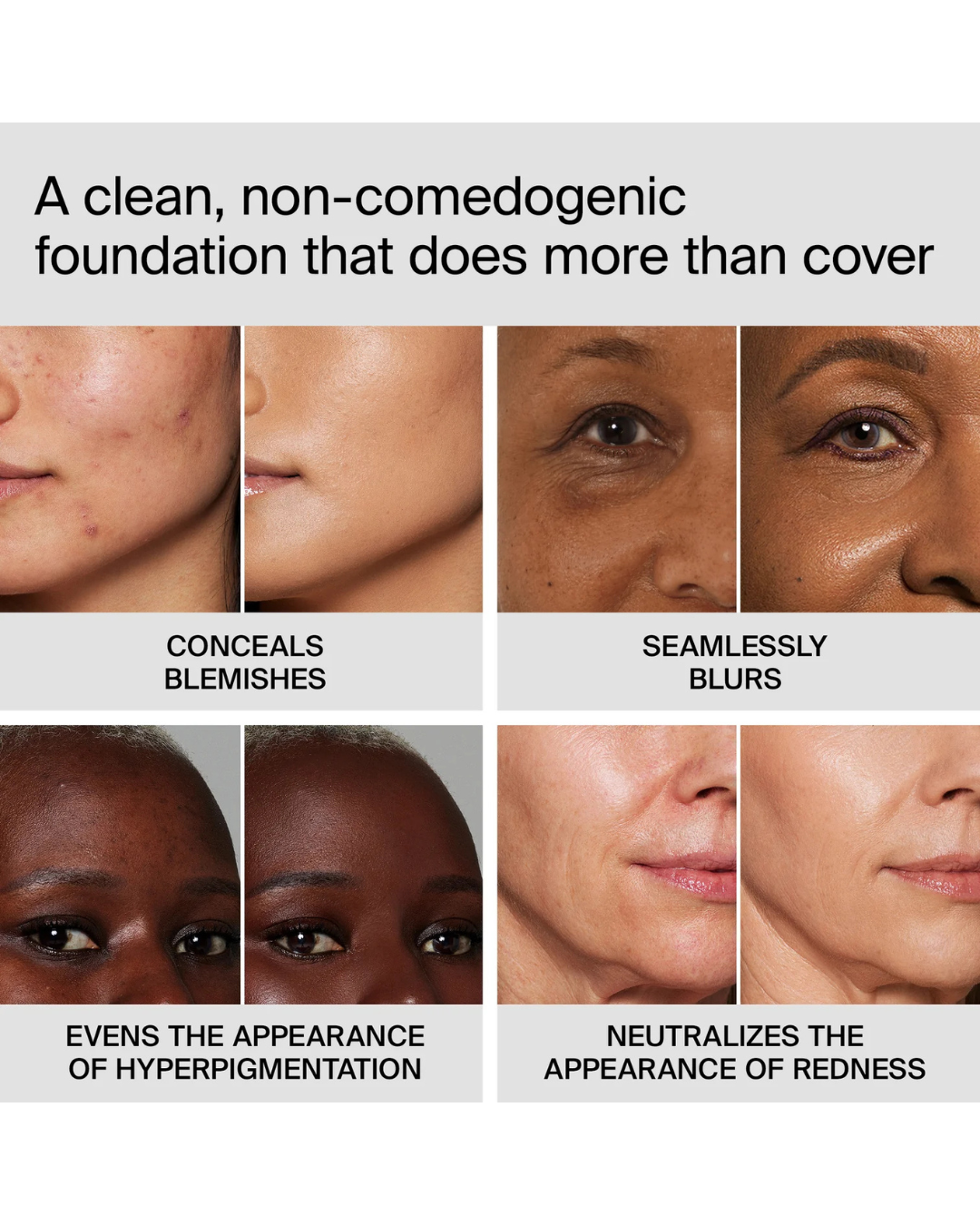 TRICLONE™ SKIN TECH MEDIUM COVERAGE FOUNDATION