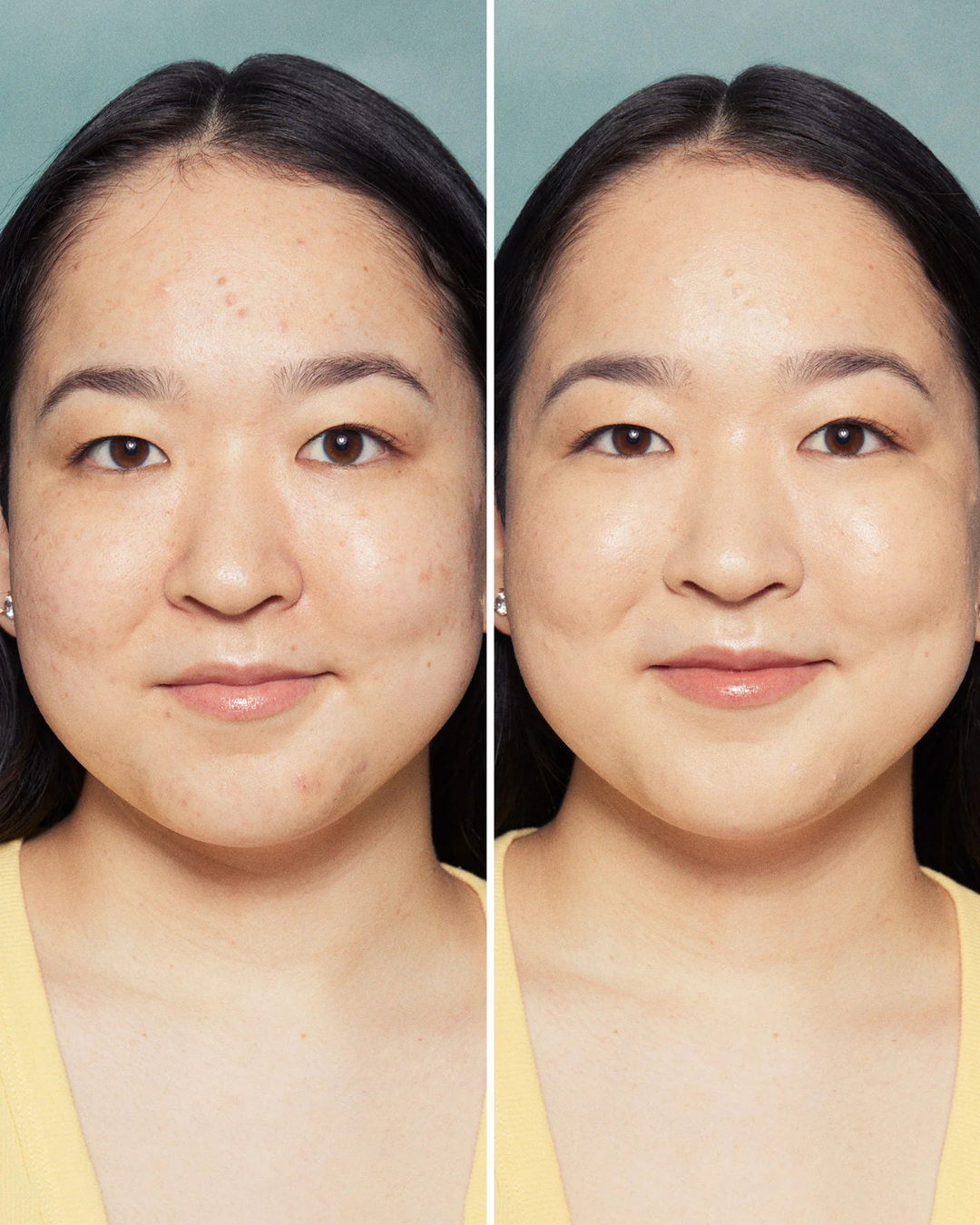 Positive Light Tinted Moisturizer Broad Spectrum SPF 20 Sunscreen